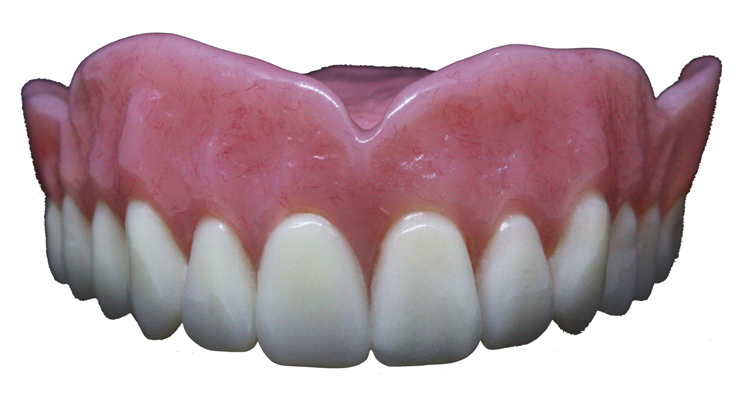 Full Dentures Ottawa Dental Laboratory IL, IN, & WI