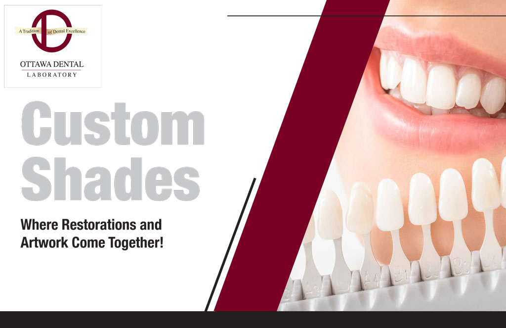 Resources Ottawa Dental Laboratory IL, IN, & WI