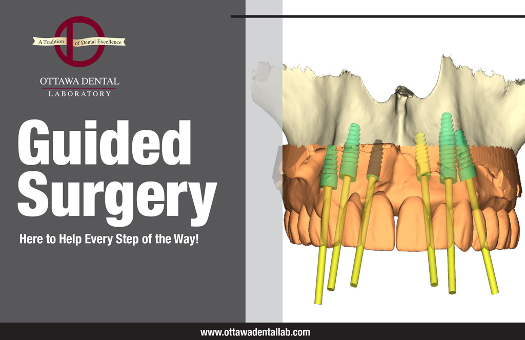 Resources Ottawa Dental Laboratory IL, IN, & WI