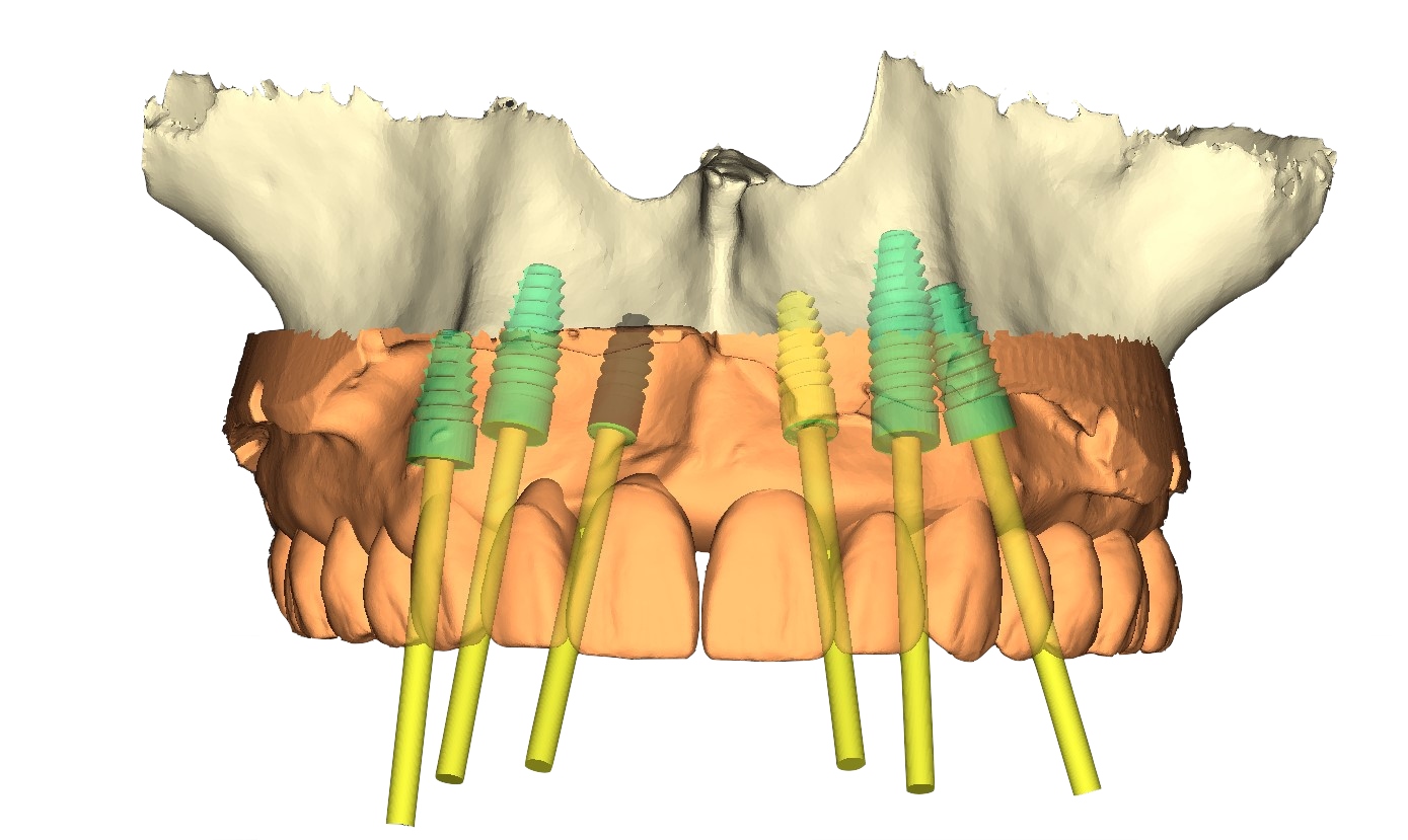 Digital Ottawa Dental Laboratory IL, IN, & WI