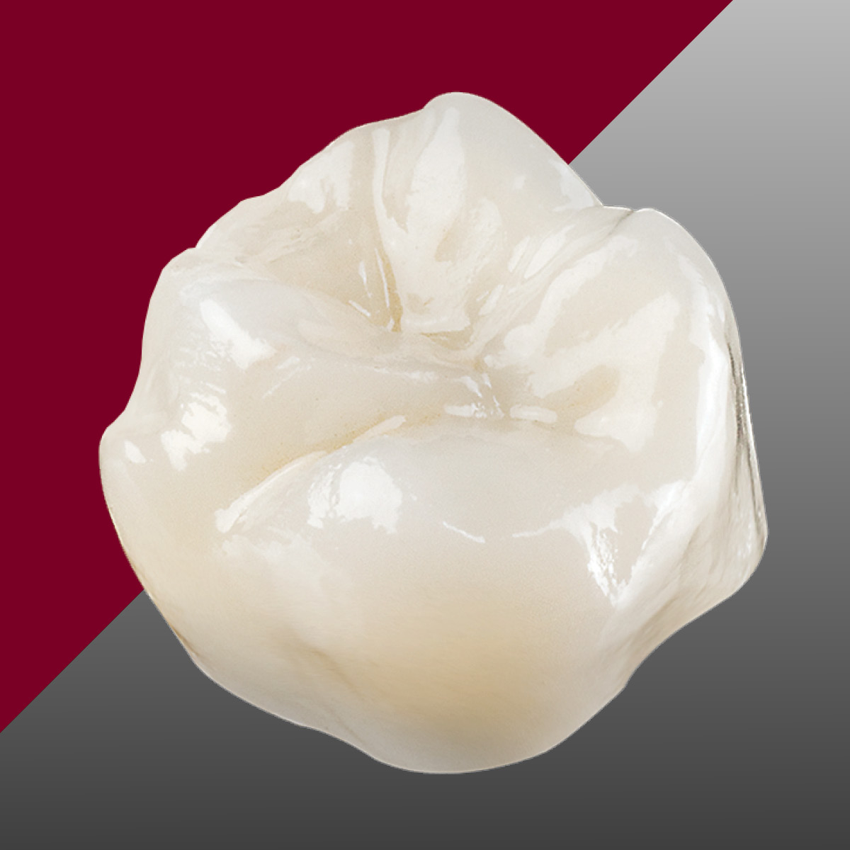 Product_Image_CX2 Ottawa Dental Laboratory