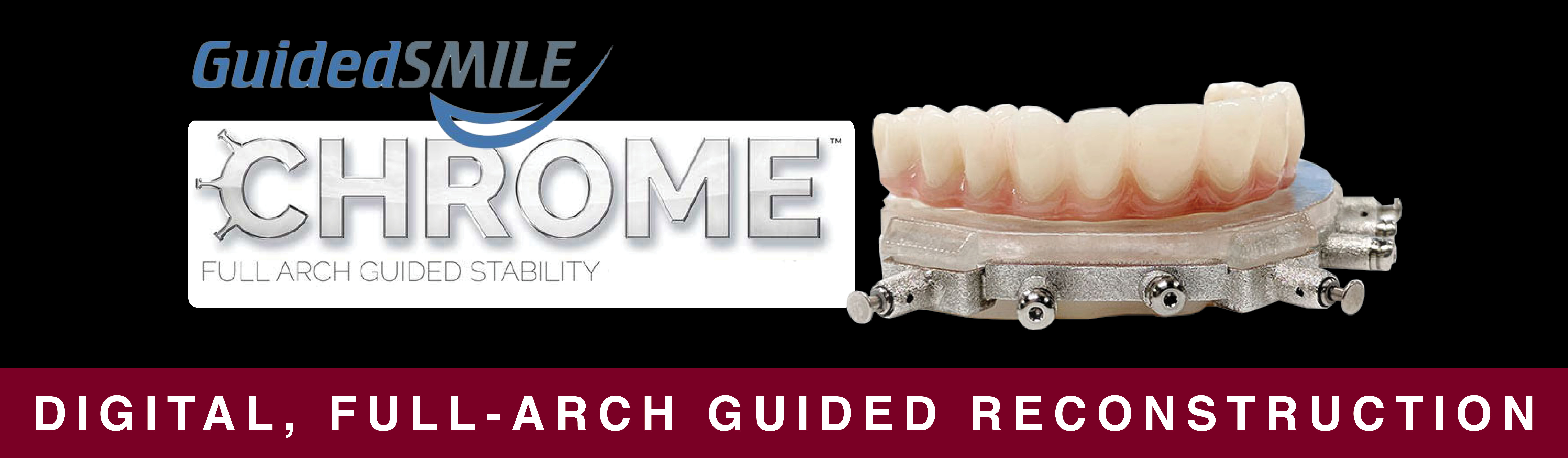 CHROME™ GuidedSmile Ottawa Dental Laboratory