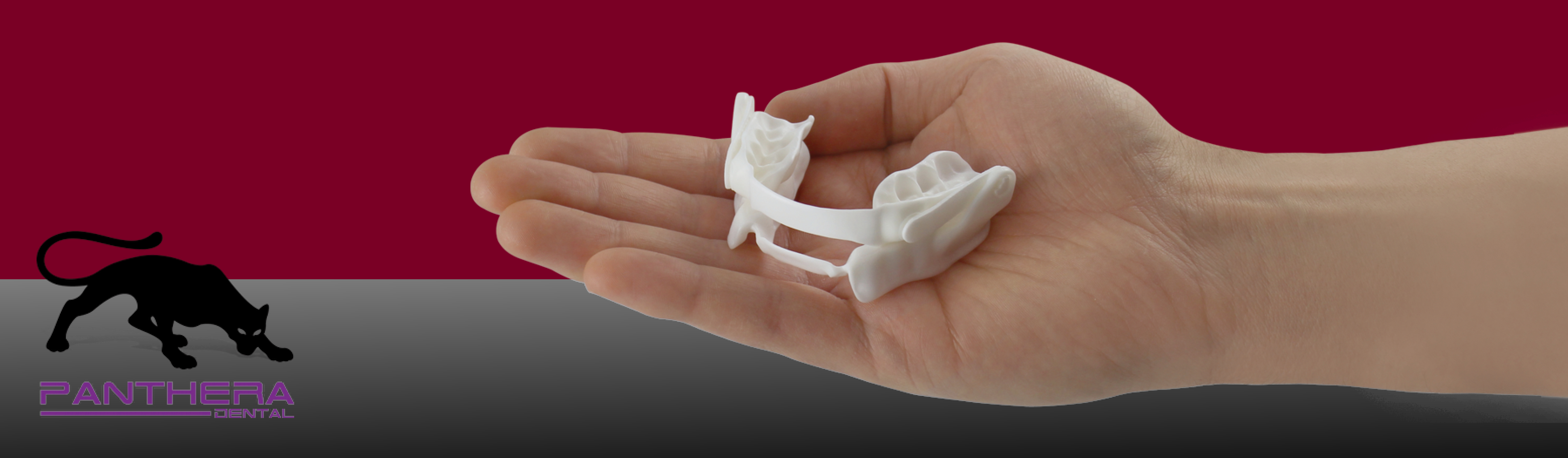 Panthera Digital Sleep Apnea Device - Ottawa Dental Laboratory