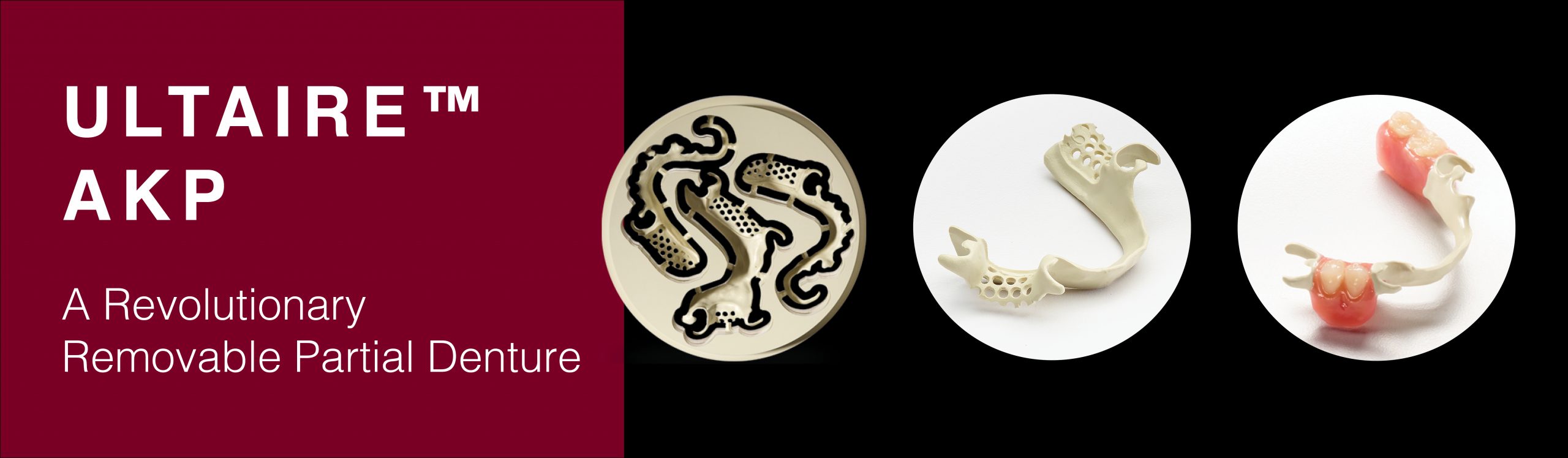 Ultaire™ AKP Ottawa Dental Laboratory
