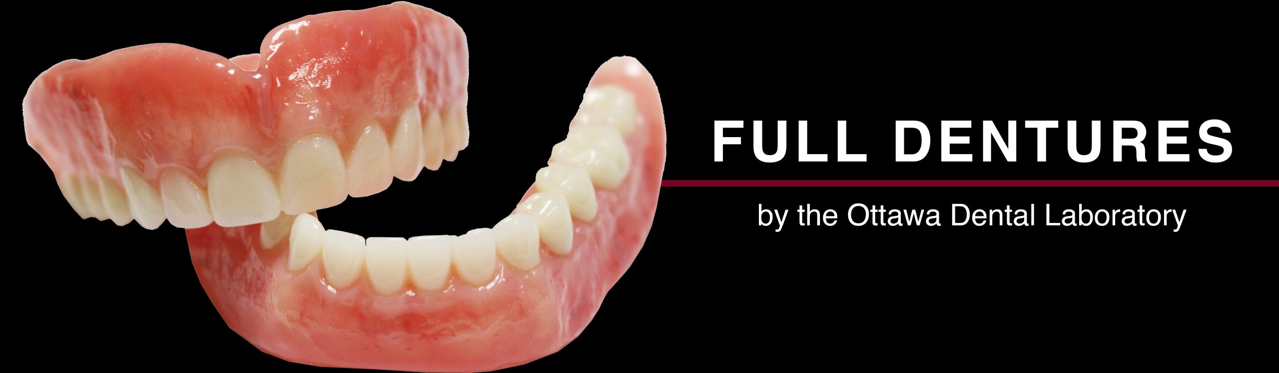 Full Dentures Ottawa Dental Laboratory