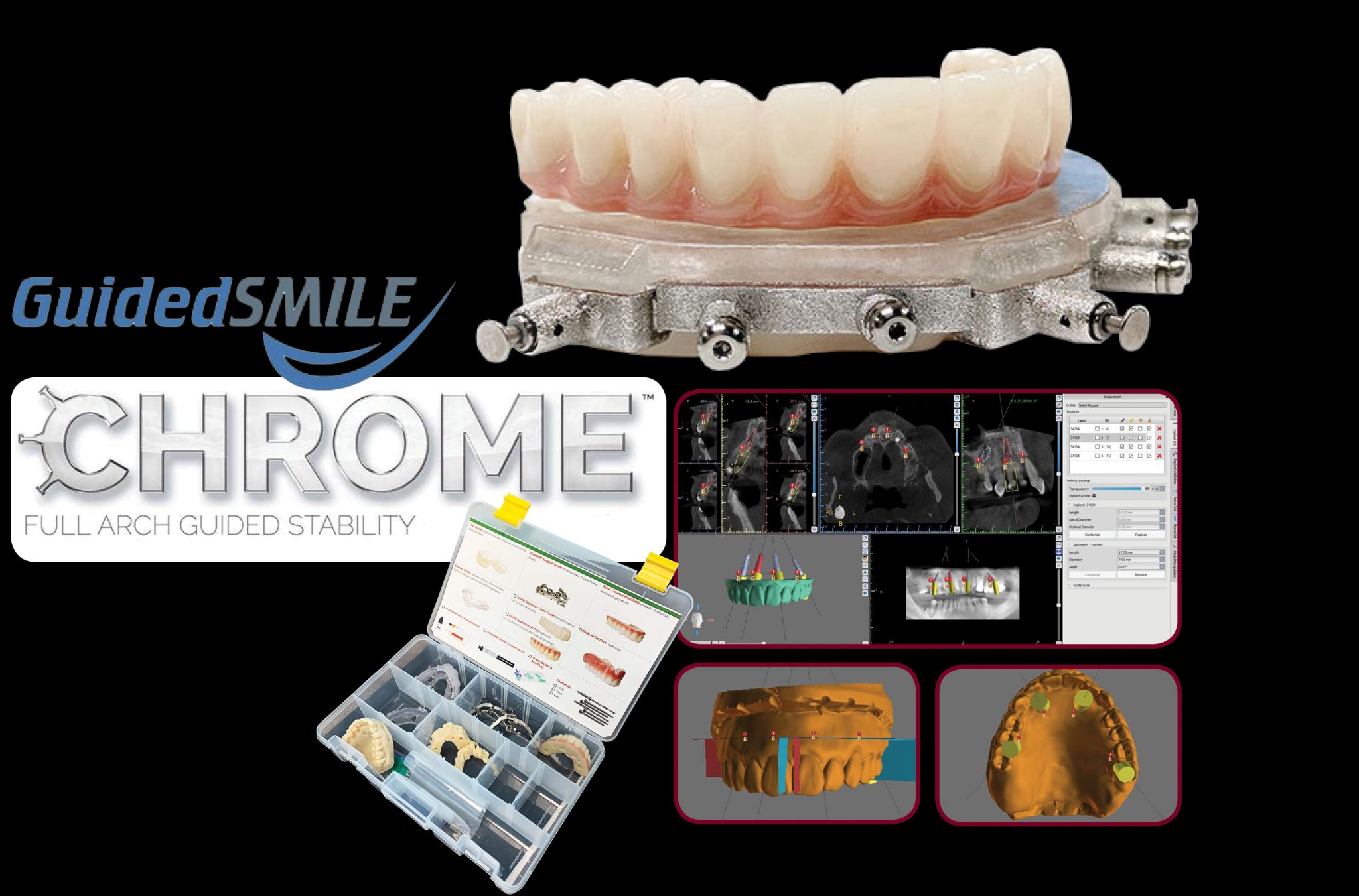 Products Ottawa Dental Laboratory